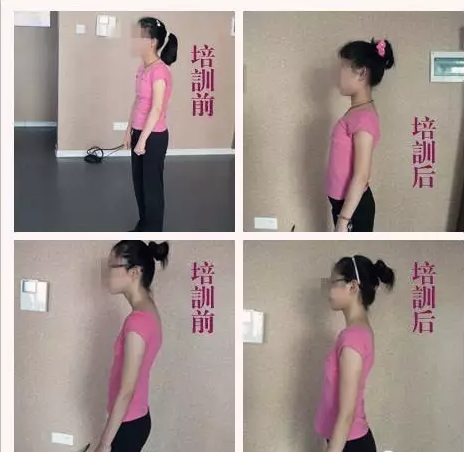 2,仪态训练  (1)站姿训练(纠正驼背,颈部错位,腹部肥胖,斜肩等)  (2)
